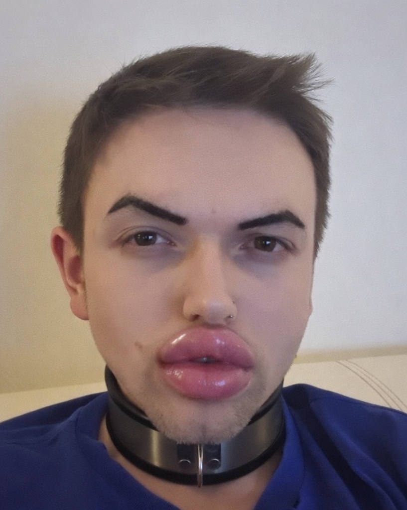 Kai Elbeshausen die Peinliche Transe