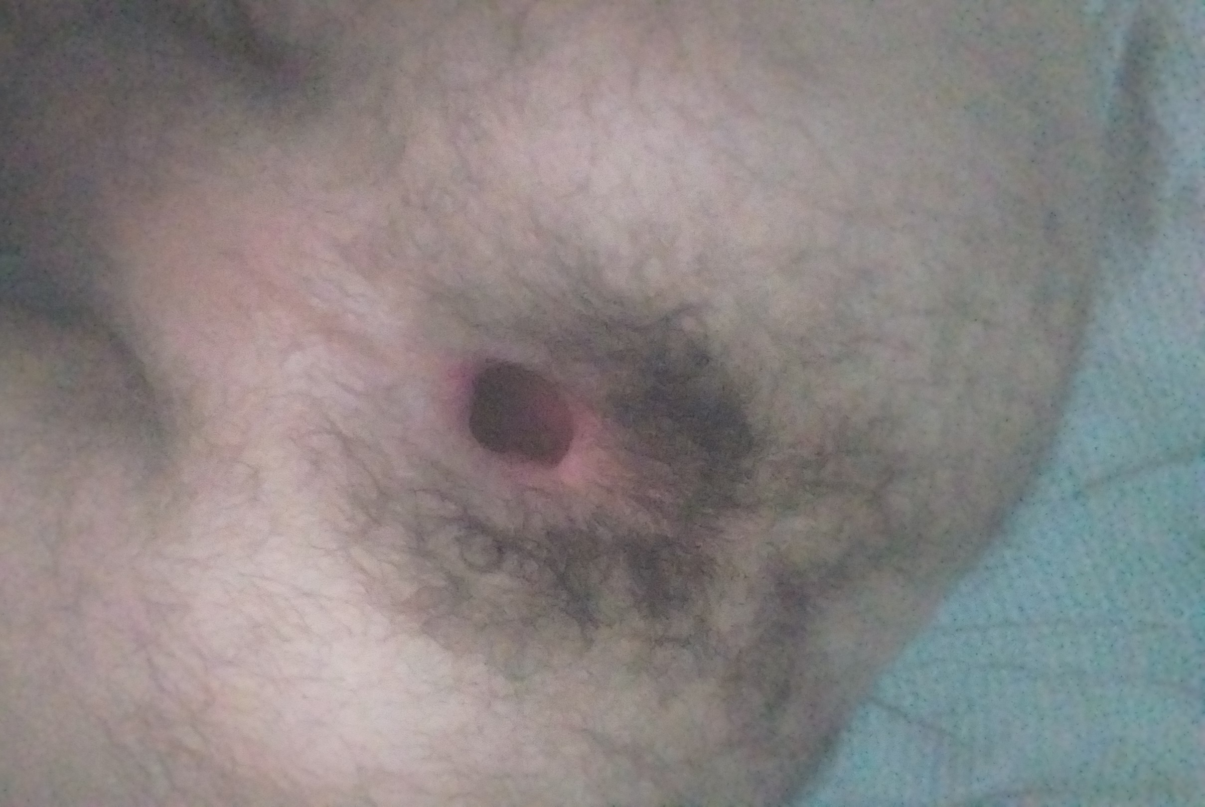 I widened my asshole 🥰