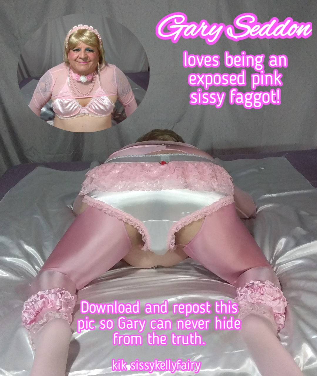 Sissyf*g Gary Seddon is begging for exposure again!
